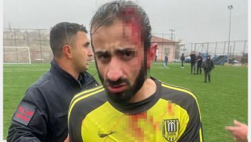 'Futbolcu Yaralandı, Hakemin Maçı Tatil Etmesi Gerekiyordu, Devam Ettirdi'