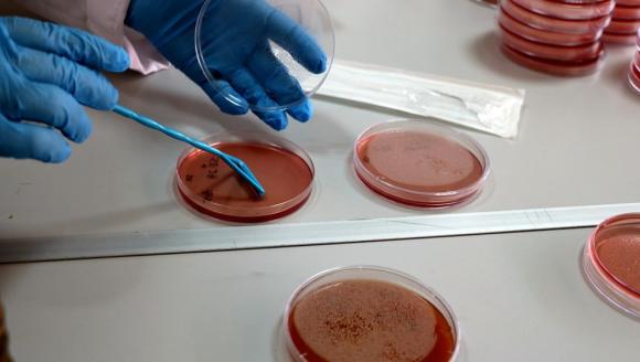 'Çiğ Süt, Bakteriler İçin Bir Taşıyıcı Ortam Olabilir'