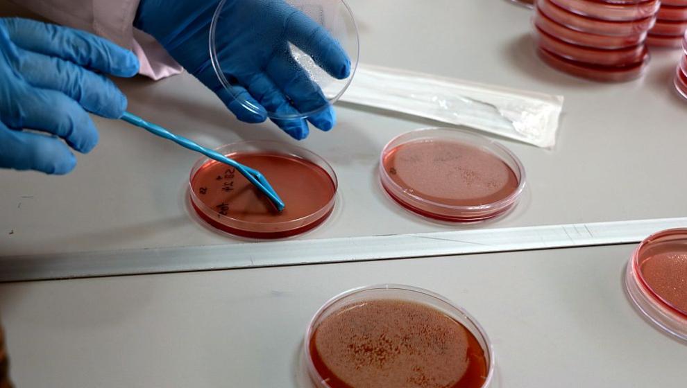 'Çiğ Süt, Bakteriler İçin Bir Taşıyıcı Ortam Olabilir'