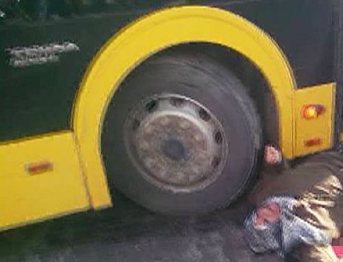 Otobüs Çarptı Ağır Yaraladı