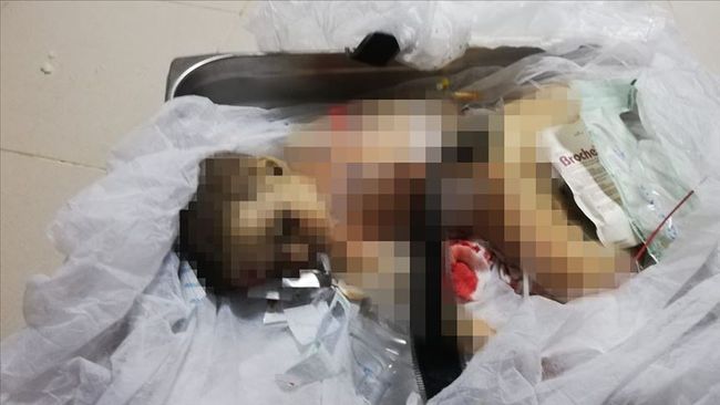 YPG/PKK Bebek ve Çocuk Öldürdü