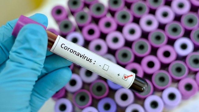 Koronavirüsün Yeni Merkezi ABD