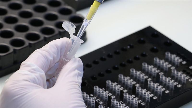 Aşısız İşçiden Haftada 1 Kez PCR İstenebilecek